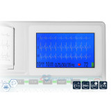 ASPEL ECG GREEN v.06.101