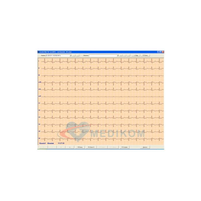 ASPEL ECG CARDIOTEKA v.211SOFT
