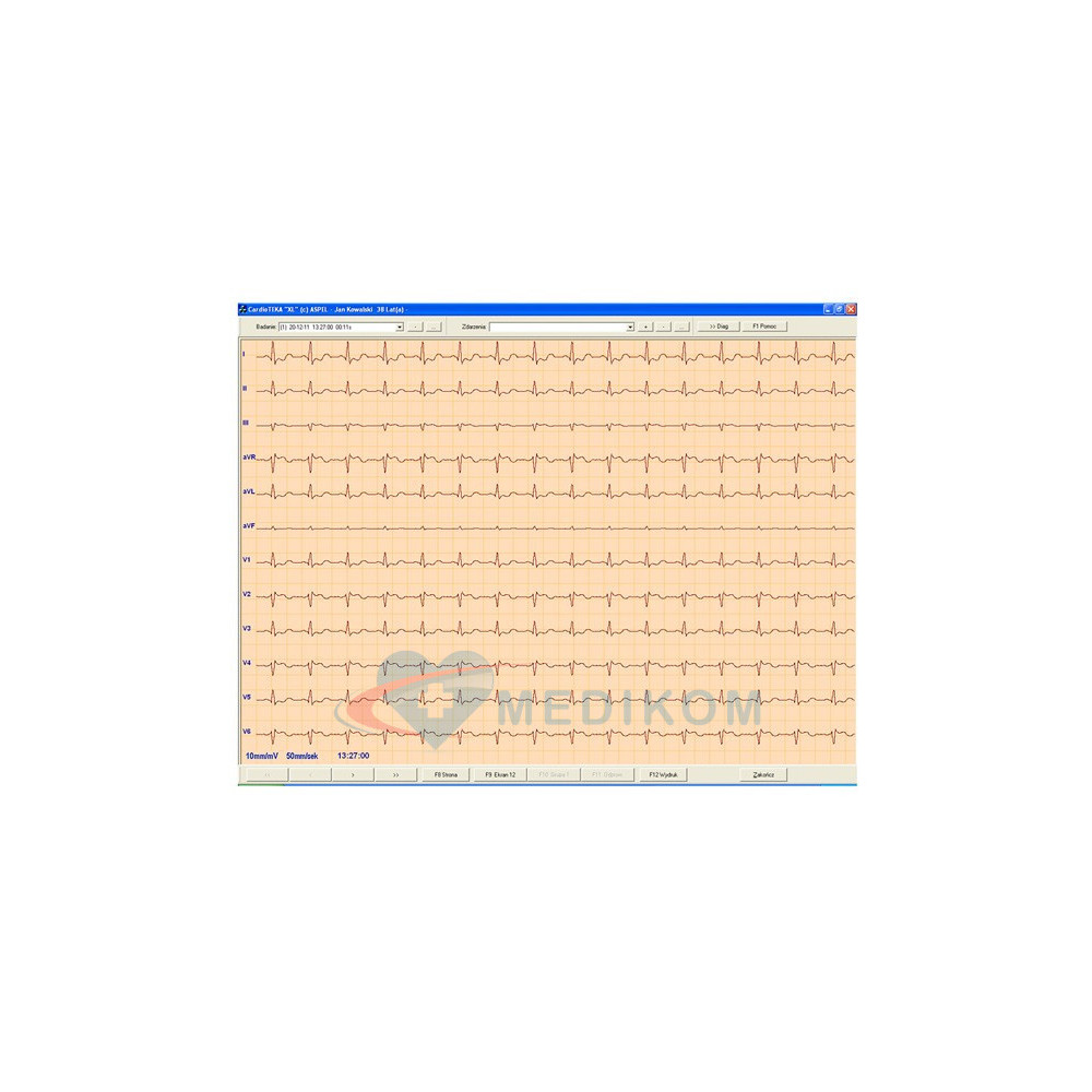 ASPEL ECG CARDIOTEKA v.211SOFTHL7