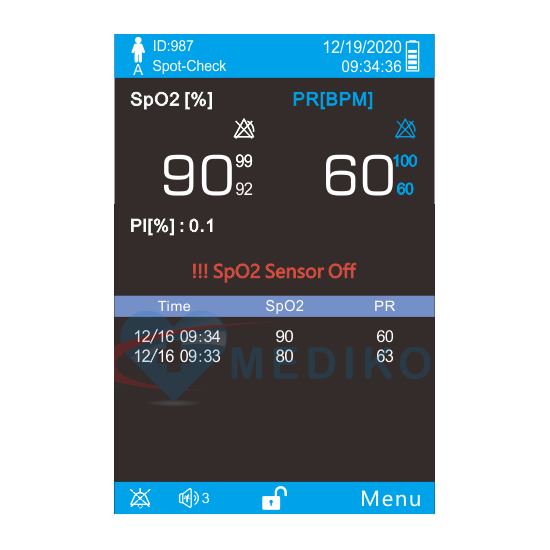 pulsoksymetr, spo2, oxymetr, pulsoxymetr, UP60, pulsoksymetr UP60, UP 60, Utech UP60, EtCO₂