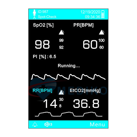 pulsoksymetr, spo2, oxymetr, pulsoxymetr, UP60, pulsoksymetr UP60, UP 60, Utech UP60, EtCO₂
