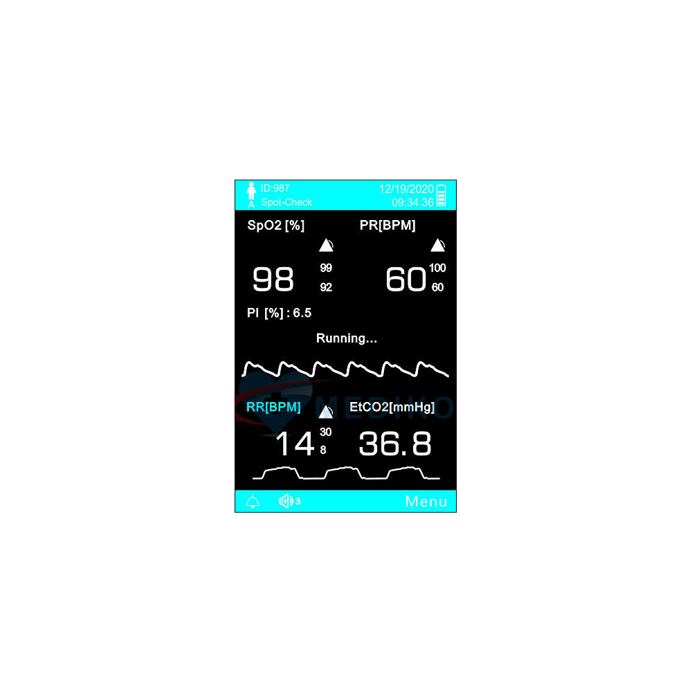 pulsoksymetr, spo2, oxymetr, pulsoxymetr, UP60, pulsoksymetr UP60, UP 60, Utech UP60, EtCO₂